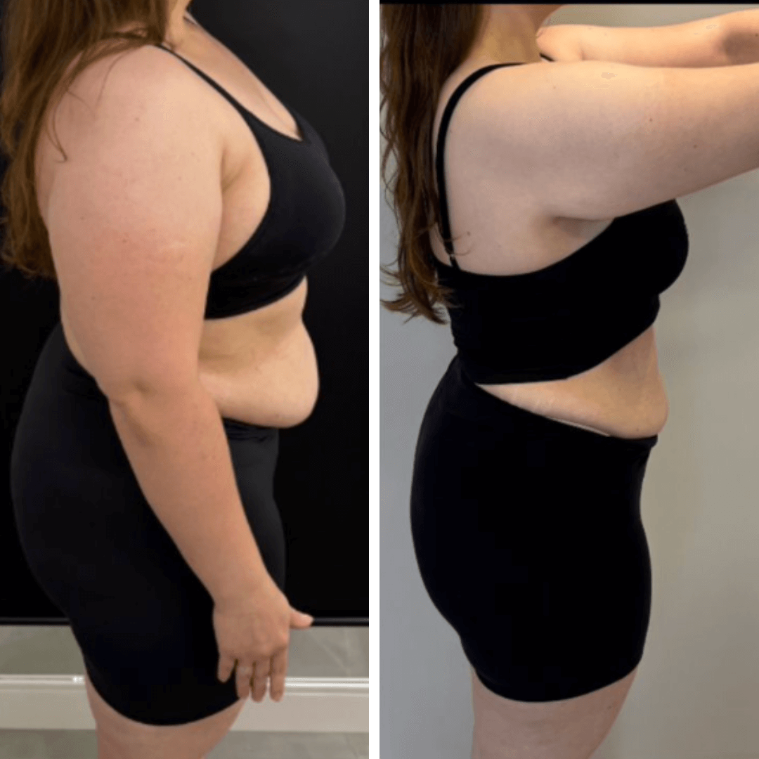 Resultado de transformação 2